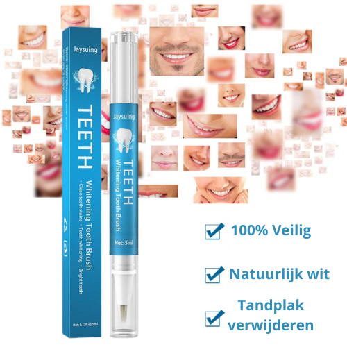 PearlSmile™ - Tandenbleekpen (1+1 GRATIS)